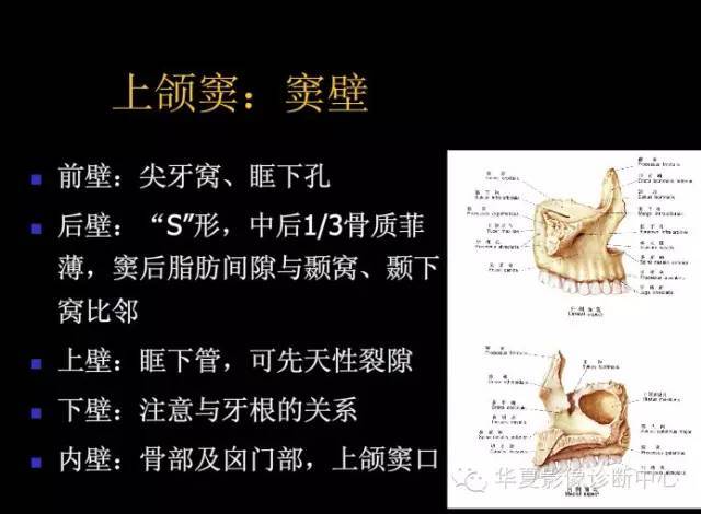 标本 影像,深度剖析 — 鼻骨,鼻副窦解剖