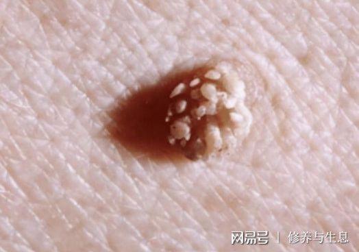 然后就是大腿根部以及私处.