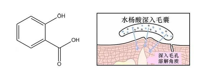 解决这样的问题,最有效的方法还是 使用果酸,水杨酸等酸性的焕肤类