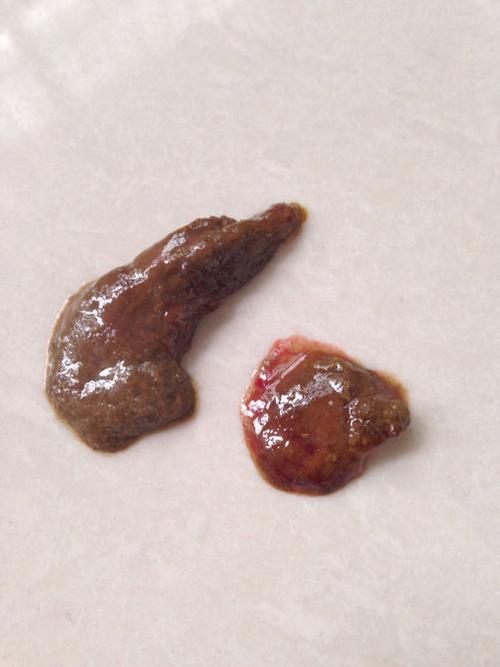 的还是成型的大便,下午就成这样了,急啊,刚刚带它看医生了,说不是细小