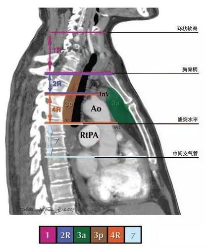 今日分享 — 纵隔淋巴结分区图谱