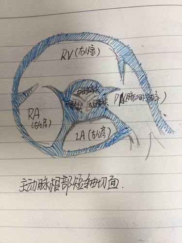 心脏彩超之常用切面