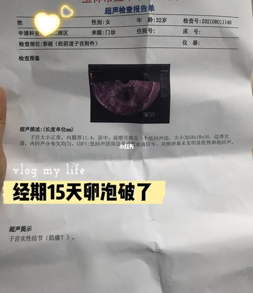 卵泡自己破了_怀孕_母婴_孕产经验