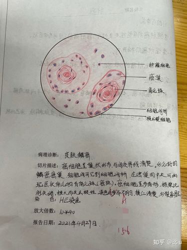 病理学实验绘图红蓝铅笔