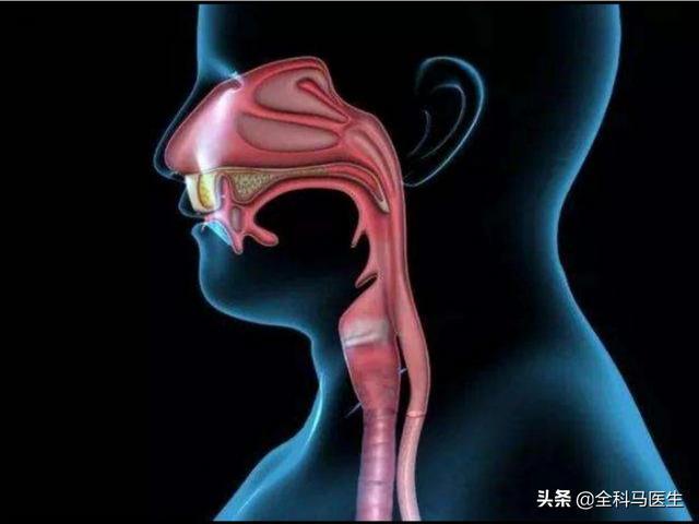 就是咽喉部出现的异物感,很多食道癌患者早期会出现这种症状,但是没有