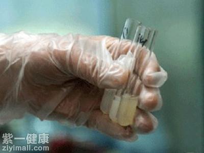 如何辨别精液健康与否 从四方面入手轻松分辨