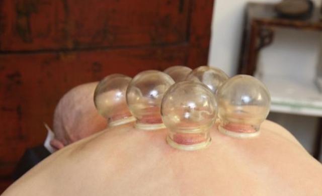 拔罐和刮痧,对身体有益还是有害?哪种更好?现在为您揭晓答案