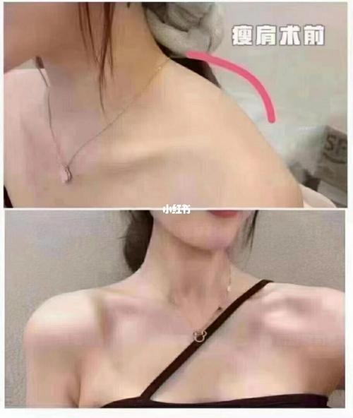 脖子较短的人 2.