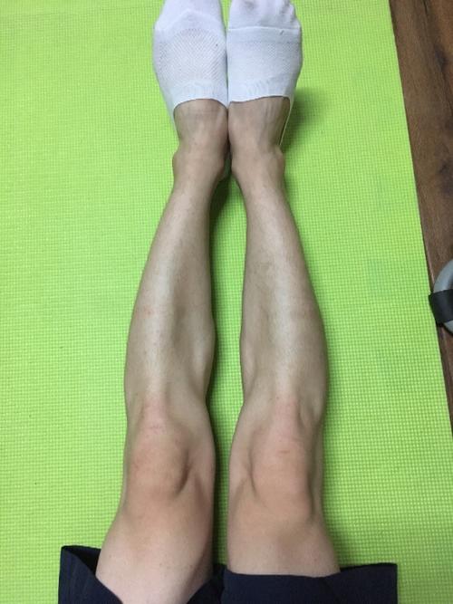 本人男,小腿较粗,但