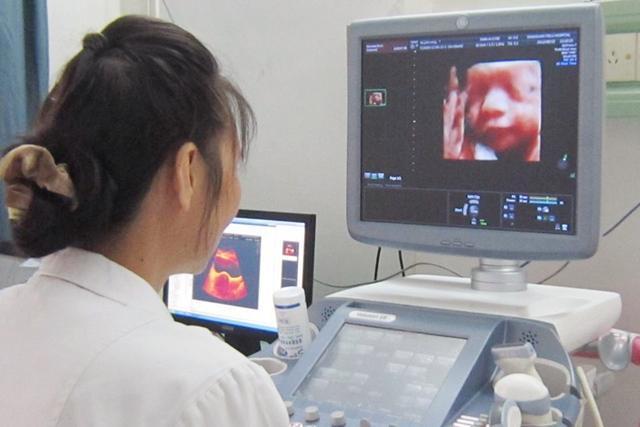 一张四维彩超检查单能轻松看出男孩女孩孕妈不要高兴得太早