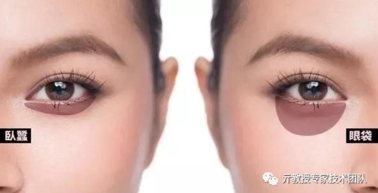 卧蚕和眼袋到底有啥区分别呢