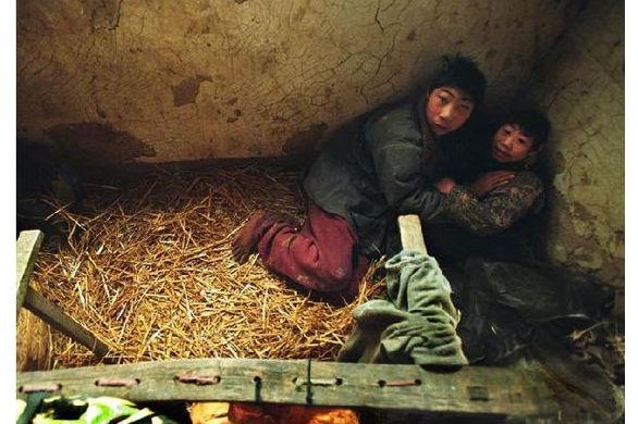 皮包骨头的艾滋病晚期病人.