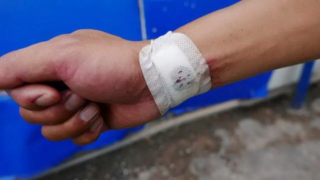 何警官右手腕被割伤.