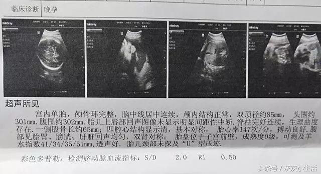 b超单常见数据解读,看懂b超单不做"懵"孕妈