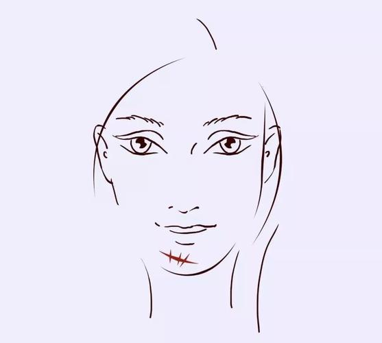 相学:脸上的疤痕对运势的影响(上)