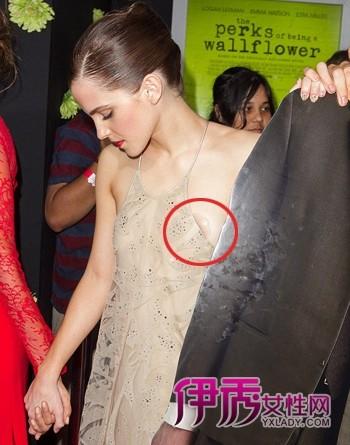 壁花少年玩走光赫敏沃特森首映现场窘态百出