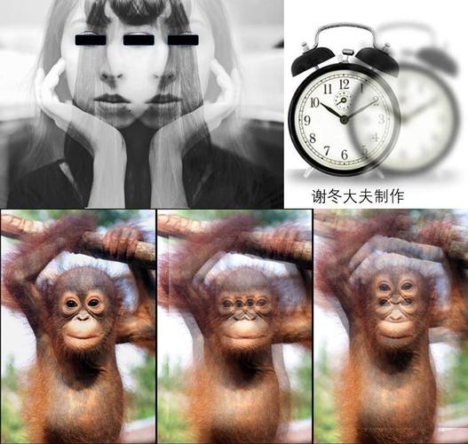 眼肌型重症肌无力 眼睑下垂,视物重影等,在发病初期,大多患者症状在