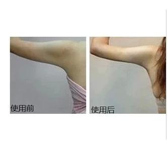 专业调配瘦手臂拜拜肉精油 告别蝴蝶袖 肉肉胳膊瘦脂肪型手臂