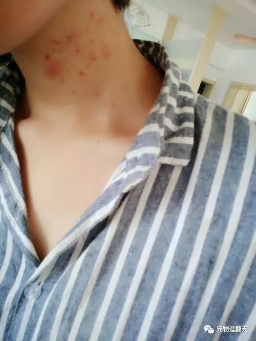 内涵,猫咪在女主人脖子上种草莓和踩奶,网友:谁吸的不