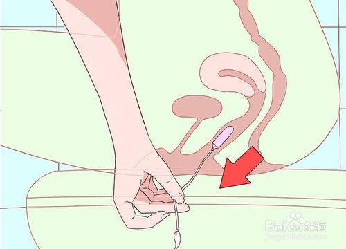 如何处置卫生棉条