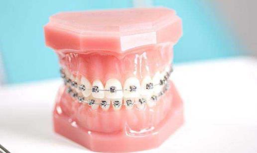 牙齿矫正的话一般是在未满15周岁的时候通过正畸或外科手术等方法治疗