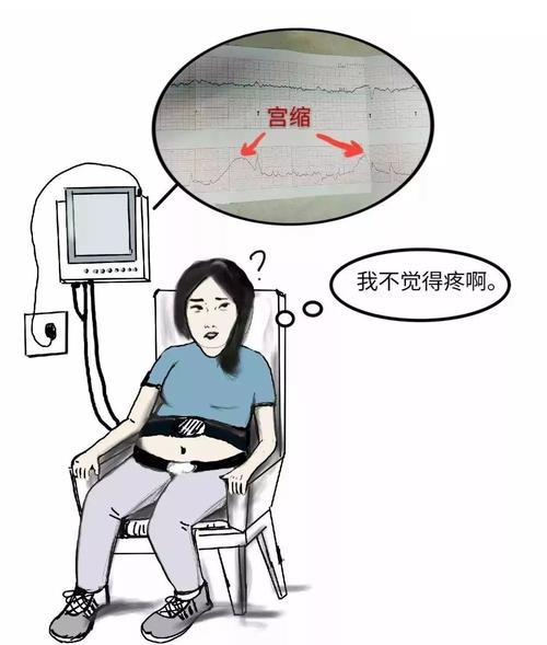 真宫缩一定是伴随着 宫颈管的消失,宫颈口的扩张和胎头的下降.