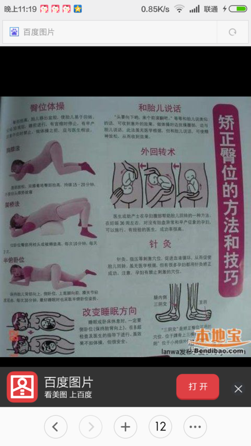 有没有胎位不正医生让做胸膝卧位操的?取消只看楼主