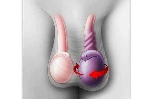 小男孩突发下腹痛可能是这个病,影响生育功能!_睾丸