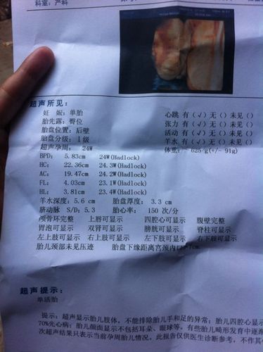 说胎儿偏小,请问是吗?这是25周