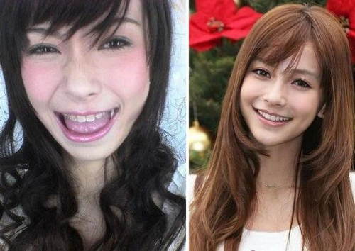 原来他们都戴过牙套 惊爆明星们的牙套岁月