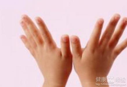 手指骨质增生的症状?