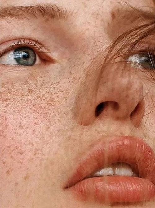 你脸上的斑是天赐的可爱礼物