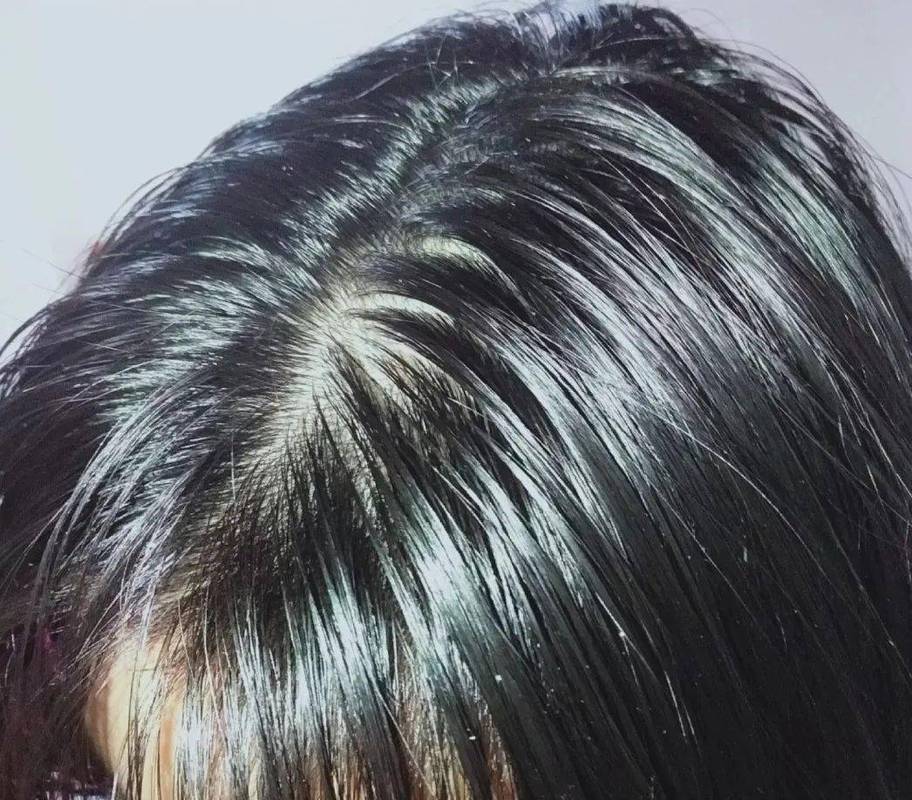 但是晚上回家的时候头发就已经开始出油了 ,软塌塌的贴在头皮上,感觉