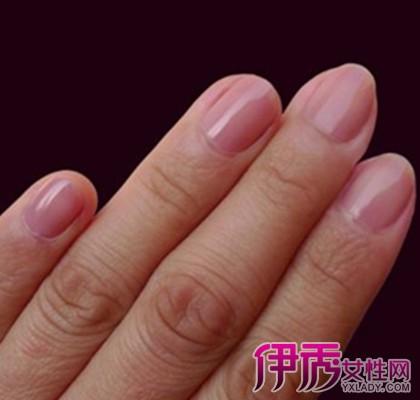 通过观察指甲看健康图解 秒懂3种状态的代表意义