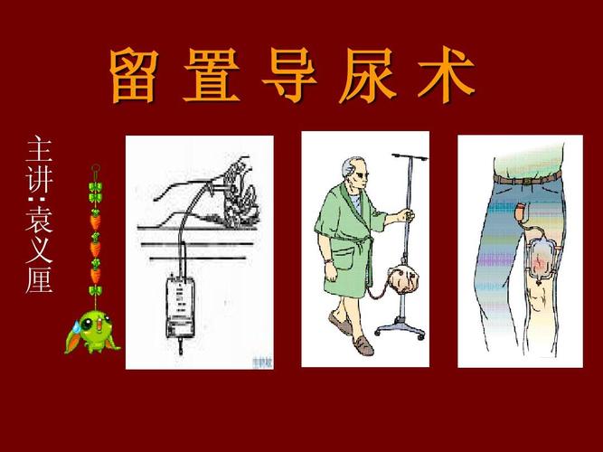 留置导尿术ppt