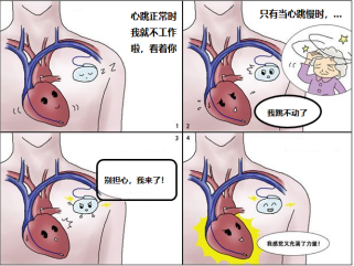心脏起搏器都怕什么?列个清单吧