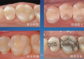 网友花式补牙欣赏有些钱还是让牙医赚吧