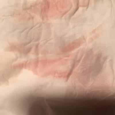 大姨妈推迟5天,hcg结果是81,今天肚子疼,上厕所纸上粉色的,是不是怀孕