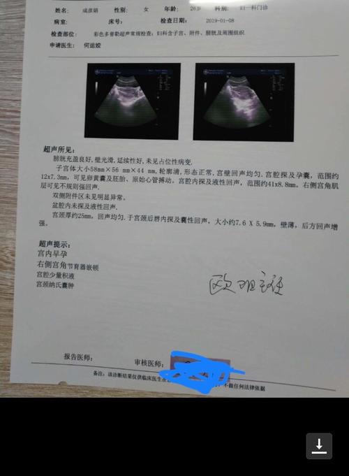 节育环"长肉里",别害怕,[内黄县二院·妇产科]轻松取出来!