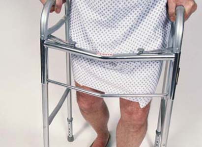 骨癌的早期信号