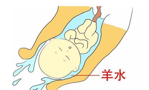 孕晚期羊水破了该如何冷静应对?