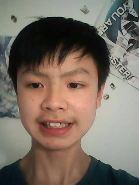 我是男生,15岁,有两颗小虎牙,请问要不要矫正啊,听别人说好像也没什么