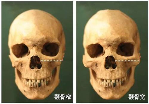 论脸大的重要性,张天爱的瓜子脸都老成了40岁.