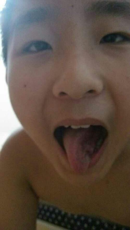 大宝的舌头能立起来
