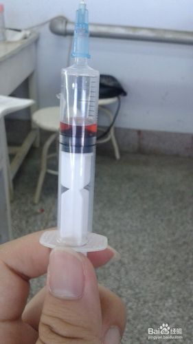 怎样静脉采血(模型)