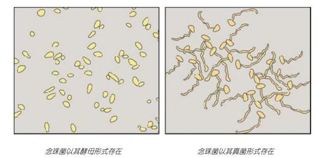 肠道念珠菌真菌形态引起的便秘腹泻胀气等肠易激综合症问题