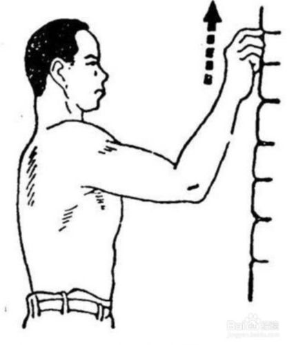 肩周围疼痛不一定是肩周炎,肩周炎自我诊断方法