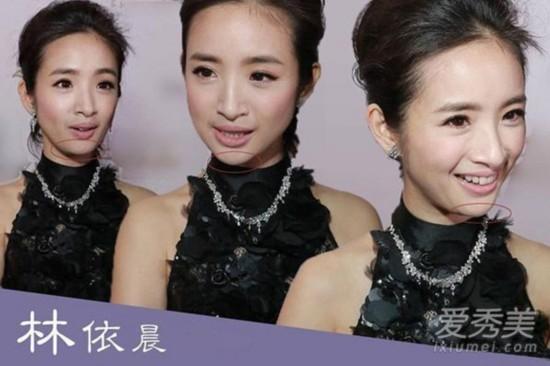 姚笛郑爽 明星整容变锥子脸尖下巴美吗?