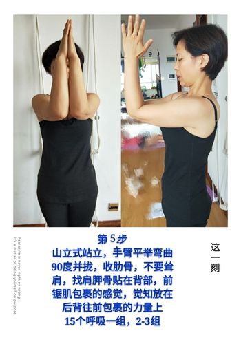 翼状肩胛骨理疗方案