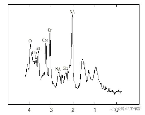 磁共振波谱成像技术( magnetic resonance spectroscopy,mrs )